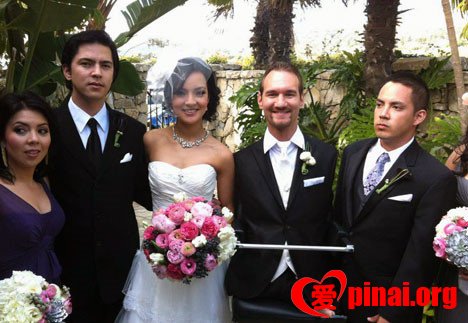 尼克胡哲结婚